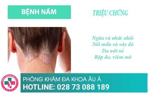 Bệnh viện da liễu Hồ Chí Minh