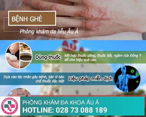 Cách trị ghẻ an toàn và hiệu quả trong 1 lần áp dụng