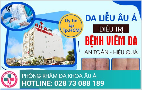 Địa chỉ chữa bệnh viêm da uy tín tại TP.HCM Địa chỉ chữa bệnh viêm da uy tín tại TP.HCM