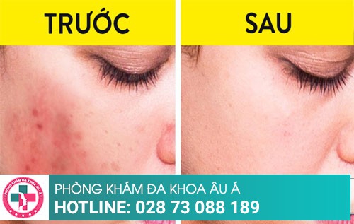 Nổi nốt đỏ trên da và ngứa – biểu hiện lạ chớ nên xem thường