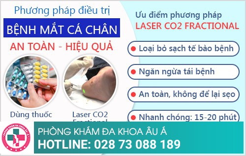 điều trị bệnh mắt cá chân điều trị bệnh mắt cá chân