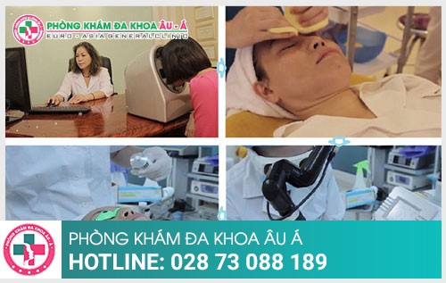 Triệu chứng nám da và cách điều trị hiệu quả mà bạn cần biết