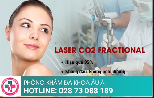 Ưu điểm của phương pháp Laser CO2 Frational