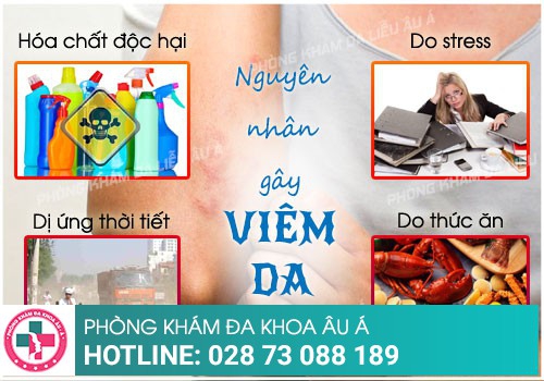 Viêm da: Triệu chứng, nguyên nhân và chẩn đoán điều trị